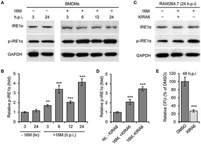 Activation of Host IRE1α-Dependent Signaling Axis Contributes the <mark class="highlighted">Intracellular Parasitism</mark> of Brucella melitensis